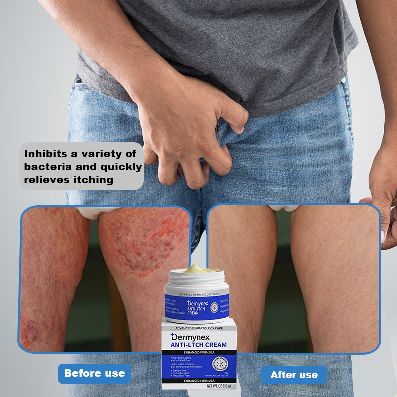 👉 Official Store: Dermynex Magnesium Herb Intimate – Fast Relief for Psoriasis & Eczema | Itch Relief, No-Rub, Steroid-Free, [Unisex] – 6-Pack Bulk Saver Set, Tax Free