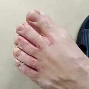 E**i P**s review image