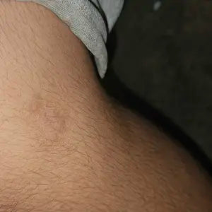 C**l p**y review image